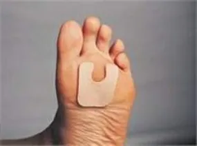 FELTastic™ Callus Pad